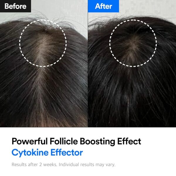 Refilled Hair-Recovery Cytokine Effector - Image 3