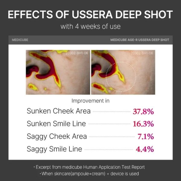 Medicube Age-R Ussera Deep Shot - Image 7