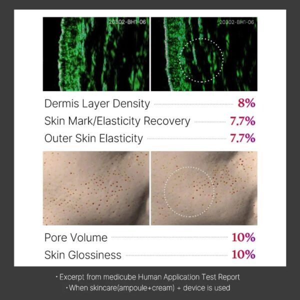 Medicube Age-R Ussera Deep Shot - Image 8