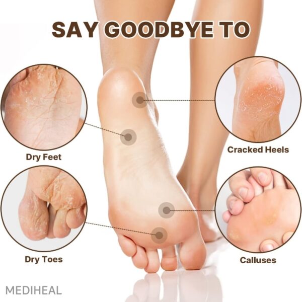 Mediheal Derma Layer Foot Mask [#5 masks] - Image 3