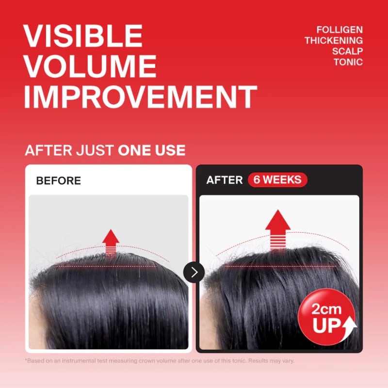Dr.FORHAIR Folligen Thickening Scalp Tonic 120ml Double Set (+Scaler+ Pokémon Hairpin) - Image 2